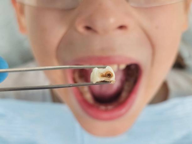 Best Emergency Dentist for Kids  in Cetronia, PA